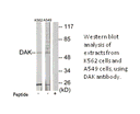 Product image for DAK Antibody