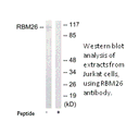 Product image for RBM26 Antibody