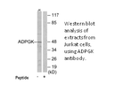 Product image for ADPGK Antibody