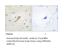 Product image for SEMA4A Antibody