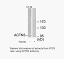 Product image for ACTN3 Antibody