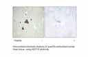 Product image for ADCY8 Antibody