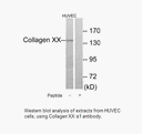Product image for Collagen XX &alpha;1 Antibody