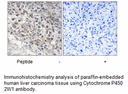 Product image for Cytochrome P450 2W1 Antibody