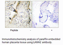 Product image for LAMA2 Antibody