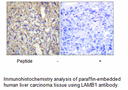 Product image for LAMB1 Antibody