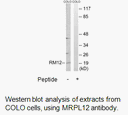 Product image for MRPL12 Antibody