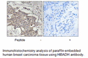 Product image for HIBADH Antibody