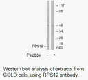 Product image for RPS12 Antibody