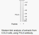 Product image for PGLS Antibody