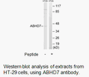 Product image for ABHD7 Antibody