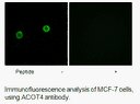 Product image for ACOT4 Antibody