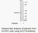 Product image for ACOT8 Antibody