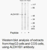 Product image for ALDH1B1 Antibody