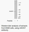 Product image for A4GNT Antibody