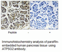 Product image for ATP5G2 Antibody
