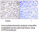 Product image for ATP5G3 Antibody