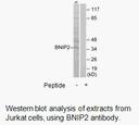 Product image for BNIP2 Antibody