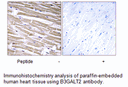 Product image for B3GALT2 Antibody
