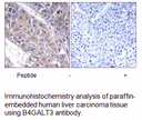 Product image for B4GALT3 Antibody