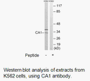 Product image for CA1 Antibody
