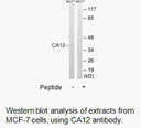 Product image for CA12 Antibody