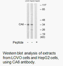 Product image for CA6 Antibody