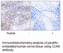 Product image for CLN6 Antibody