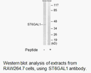 Product image for ST6GAL1 Antibody