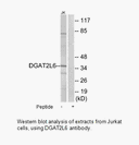 Product image for DGAT2L6 Antibody