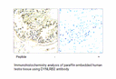 Product image for DYNLRB2 Antibody