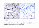 Product image for ELOVL3 Antibody