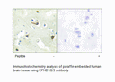 Product image for EPHB1/2/3 Antibody