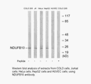 Product image for NDUFB10 Antibody