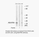 Product image for NDUFB9 Antibody