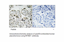 Product image for MT-ND1 Antibody