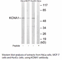 Product image for KCNA1 Antibody