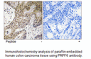 Product image for PRPF6 Antibody