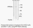 Product image for PPP1R3A Antibody