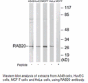 Product image for RAB20 Antibody