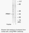 Product image for PRKY Antibody