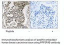 Product image for PPP2R1B Antibody