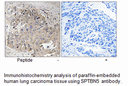 Product image for SPTBN5 Antibody