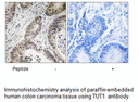 Product image for TUT1 Antibody