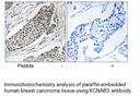Product image for KCNAB3 Antibody