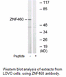 Product image for ZNF460 Antibody