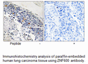 Product image for ZNF600 Antibody