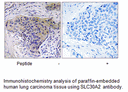 Product image for SLC30A2 Antibody