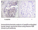 Product image for Histone H2B (Acetyl-Lys5) Antibody