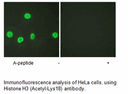 Product image for Histone H3 (Acetyl-Lys18) Antibody